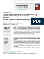 Trombosis Focal Reporte de Caso