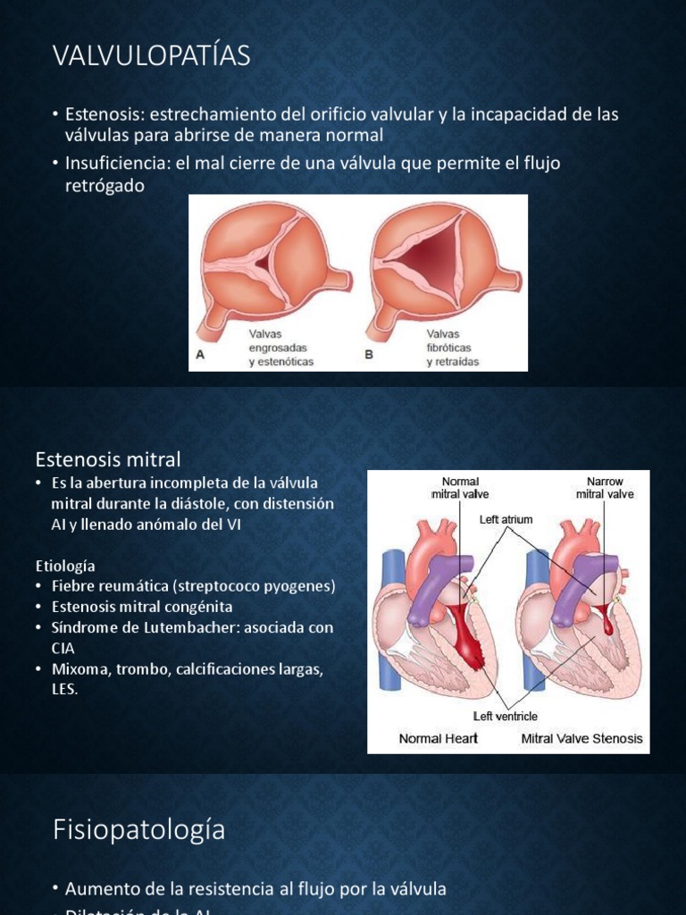 Valvulopatías Círculo | PDF | Sistema circulatorio | Sistema cardiovascular