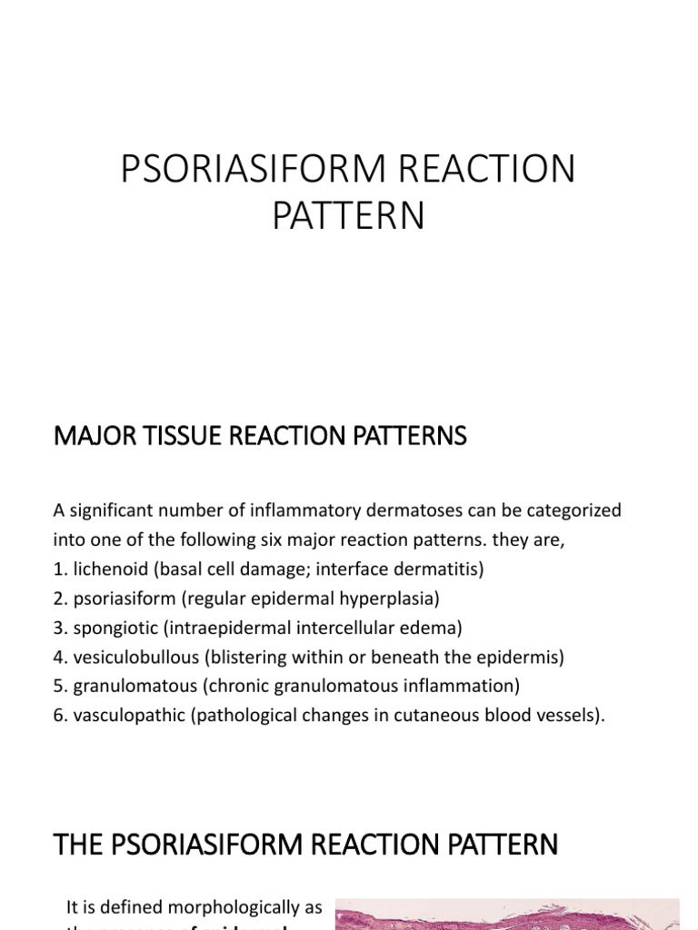 Psoriasiform Reaction Pattern Overview | PDF | Psoriasis | Epidermis