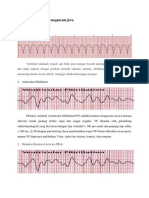 Gambaran EKG Yang Megancam Jiwa