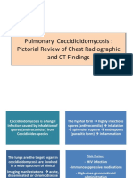 Pulmonary Coccidioidomycosis: Pictorial Review of Chest Radiographic and CT Findings