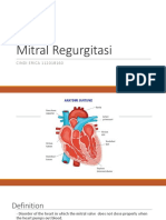 CINDI (Mitral Regurgitasi)