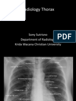 Radiology Thorax: Sony Sutrisno Department of Radiology Krida Wacana Christian University