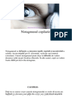 Nistagmus