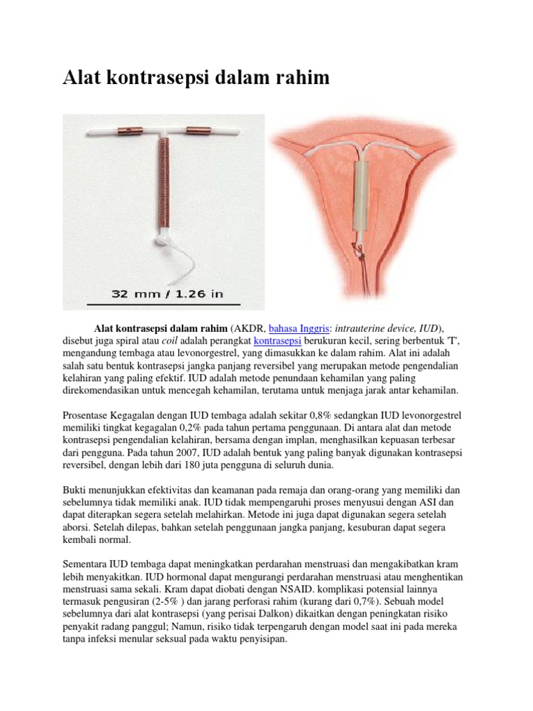 Alat Kontrasepsi IUD: Keamanan dan Efektivitas | PDF