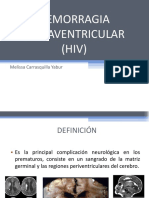 Hemorragia Intraventricular