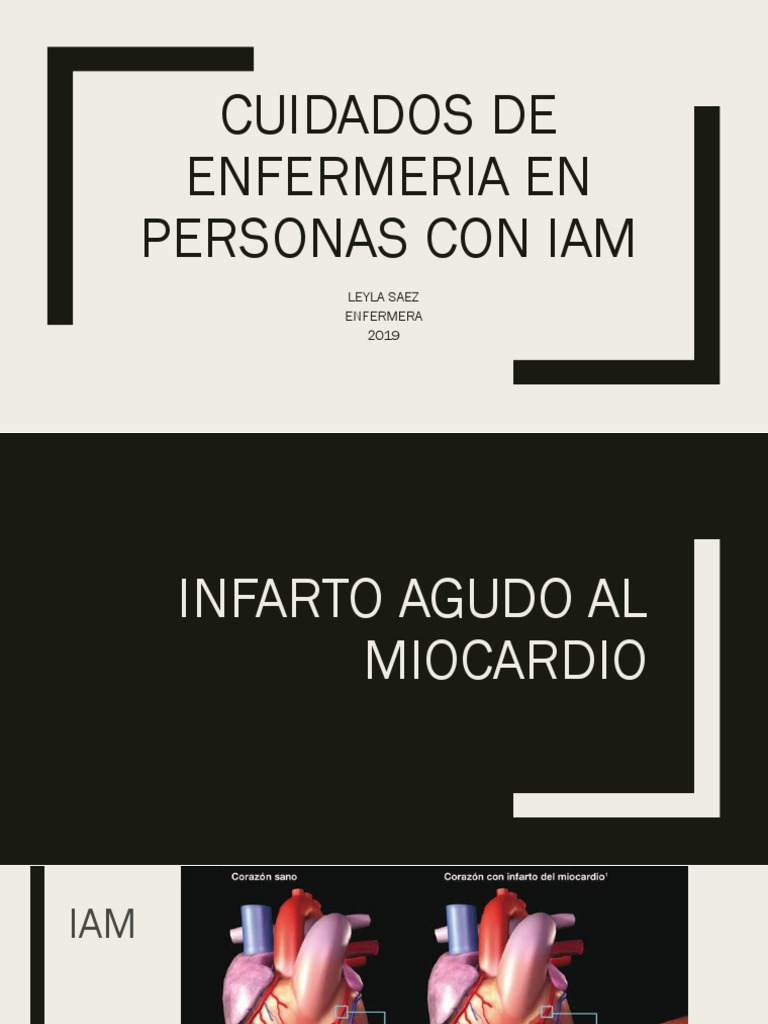 Cuidados de Enfermería en IAM | PDF | Infarto de miocardio ...