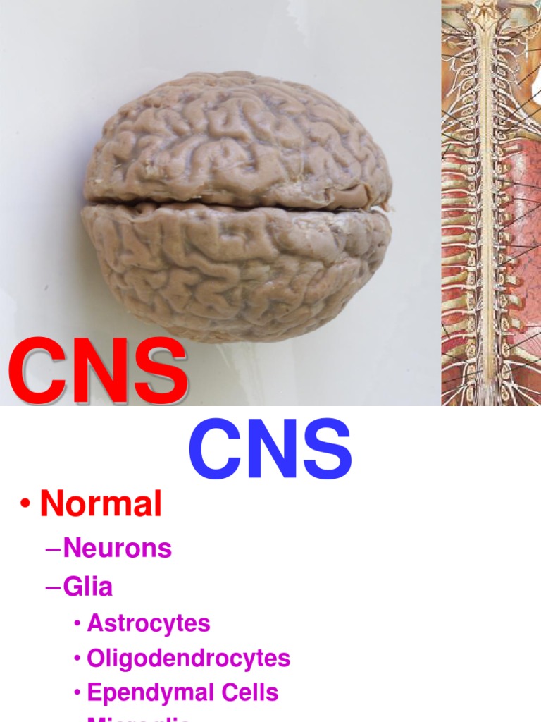 CNS Cellular Reactions and Classical Disease Patterns | PDF | Brain ...