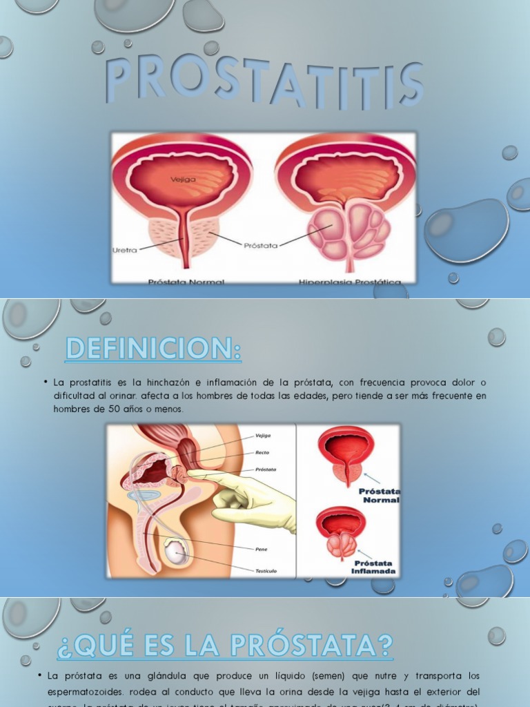treatment of prostatitis duration