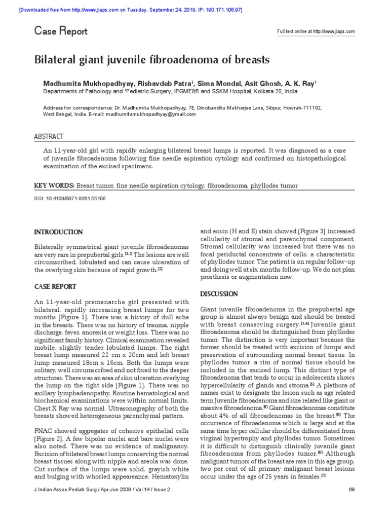 Bilateral Giant Juvenile Fibroadenoma of Breasts: Ase Eport | PDF ...