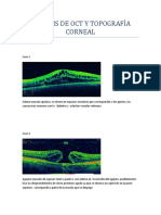 Analisis de Oct y Topografia Corneal