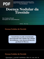 Doença Nodular da Tiróide