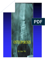 Osteoporosis USO INTEGRAL DE AMINOPEPTONAS LINFAR.pdf