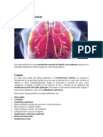 Edema Pulmonar