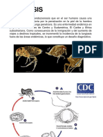 Tungiasis: Pulga Parasitaria En Pies