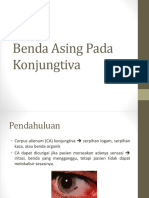 Kom 3B. 1. Benda Asing Di Konjungtiva