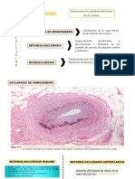 Patologia Arterioesclerosis