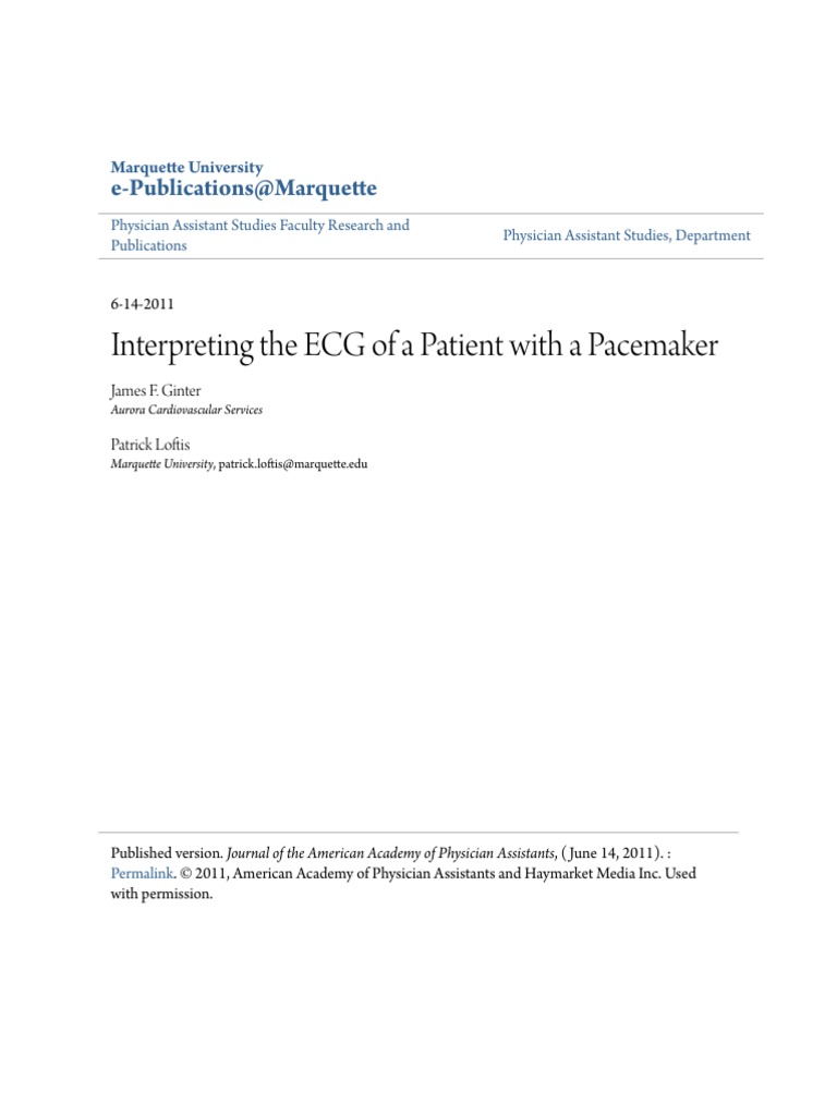 Interpreting The ECG of A Patient With A Pacemaker | PDF | Artificial ...