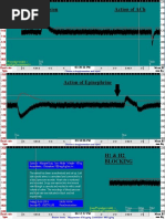 Naranjo's Causality Assessment Scale | PDF