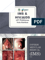 Ims Dan Hiv