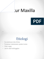 Maxillar and Mandibular Fracture-dr. Ismail.ppt