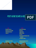 Post Acne Scars & Keloids