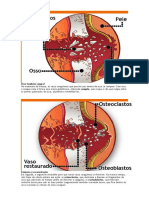 Osso Osteoclasto e Osteoblasto