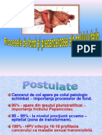 Cancerul-colului-uterin-ppt.ppt