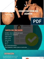 Coartación de Aorta: Amparo Castro Rueda 16022043 24 Septiembre 2019