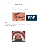 Trampa Lingual Pag 65 en Adelante