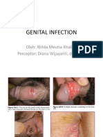 Genital Infection: Oleh: Wilda Meutia Khalida Perceptor: Diana Wijayanti, Dr. SP - KK