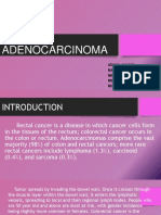 Rectal Adenocarcinoma