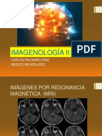 Neuroimagenes - Resonancia Magnética