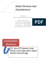 Overdenture Gigi Tiruan yang Didukung Gigi Asli