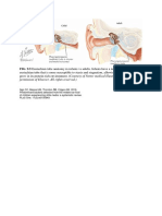 FIG. 9.5 Eustachian Tube Anatomy in Infants Vs Adults. Infants Have A Narrower Angle To The