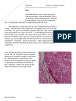 Tlas OF EAD AND ECK Athology Cinic ELL Denocarcinoma