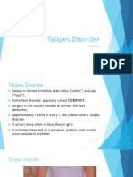 Talipes Disorder: (Clubfoot)