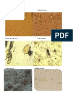 Examen Microscopico de Orina