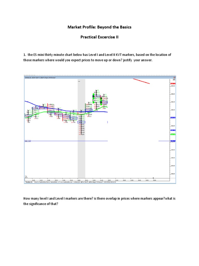 Market Profile Analysis for Traders | PDF | Market (Economics) | Economies