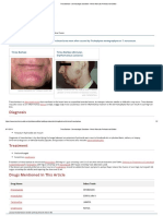 Tinea Barbae - Dermatologic Disorders - Merck Manuals Professional Edition