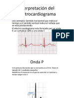 Interpretacion Del Electrocardiograma