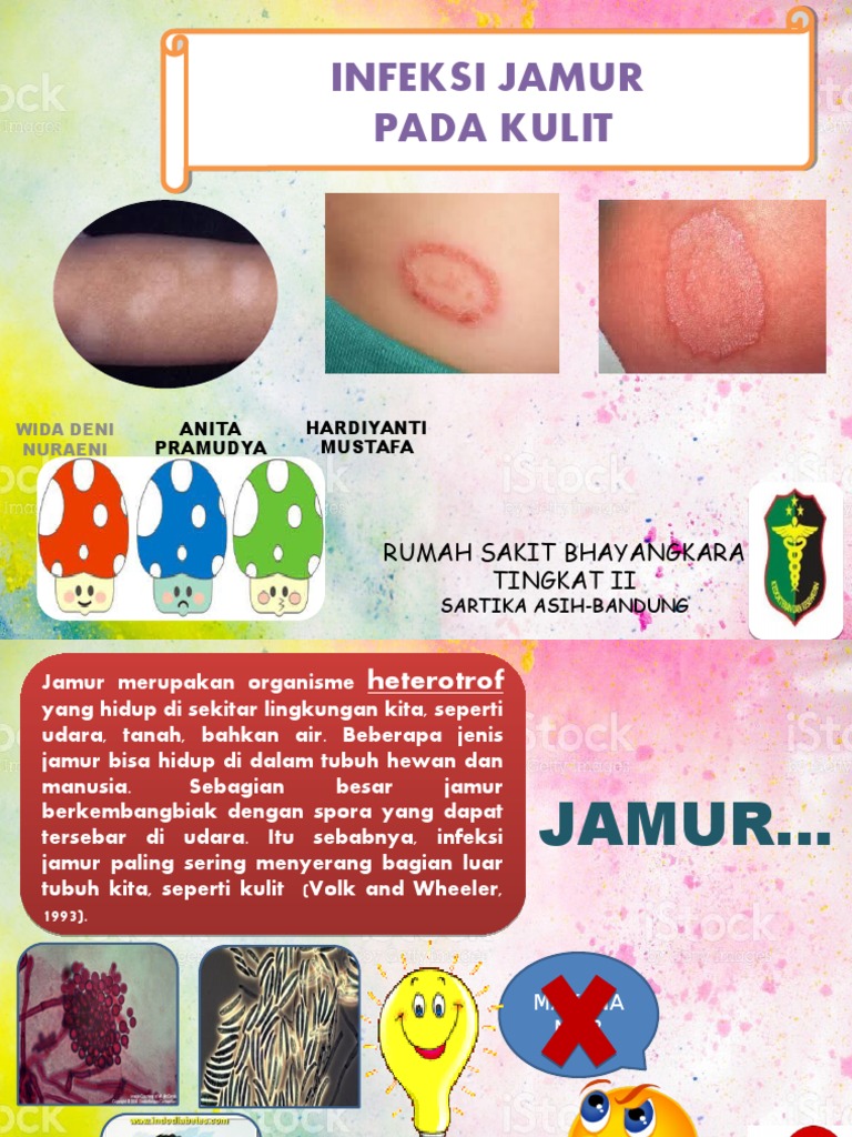 Penyebab dan Pengobatan Jamur Kulit | PDF