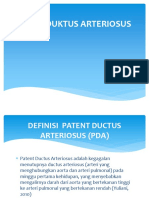 Paten Duktus Arteriosus