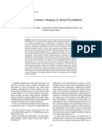 Magnetic Resonance Imaging of Spinal Dysraphism