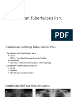 Gambaran Tuberkulosis Paru