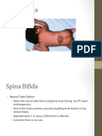 spina_bifida.ppt