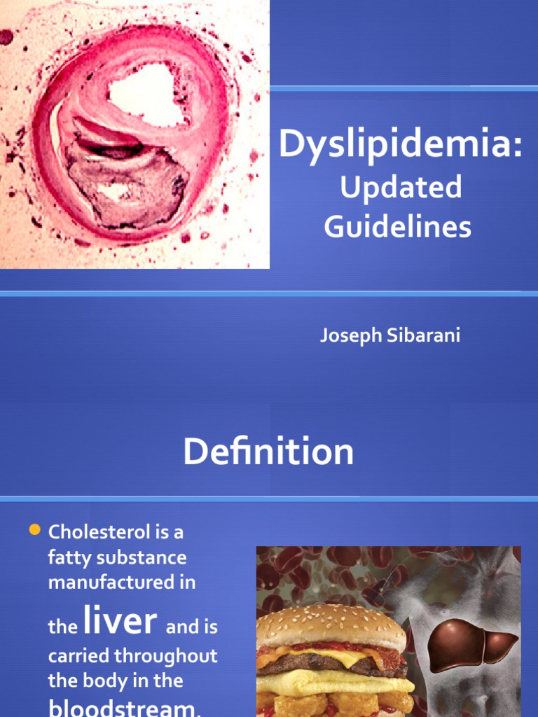Dyslipidemia Updated Guidelines PDF Statin Fish Oil