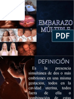 Embarazo Multiple Exponer
