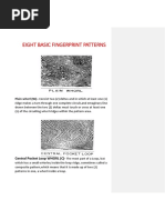 Eight Basic Fingerprint Patterns: Plain Whorl (W) - Consist Two (2) Deltas and in Which at Least One