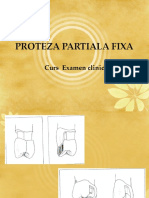 Proteza partiala fixa1
